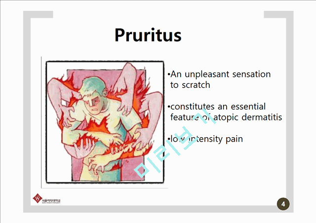 Pathophysiology and therapy of pruritus in allergic and atopic diseases   (4 )